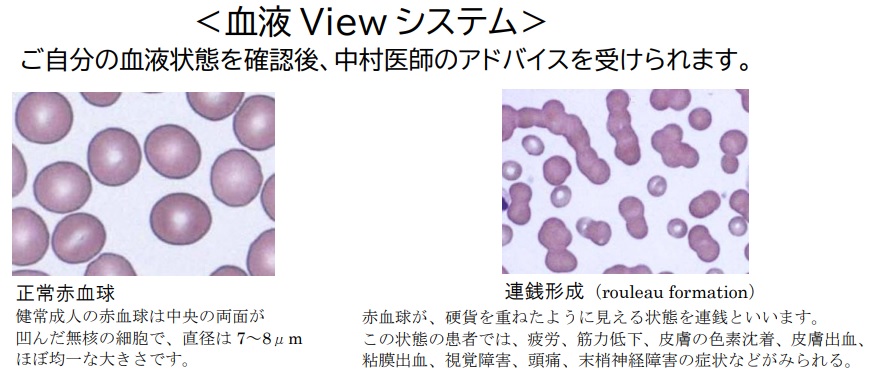 血液Viewシステム 赤血球写真
