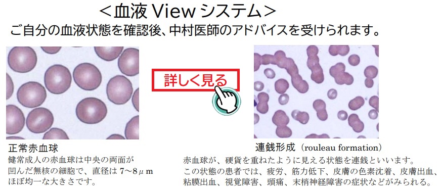 血液Viewシステム 赤血球写真